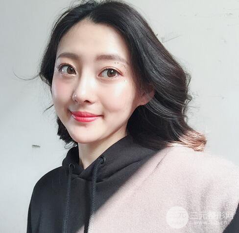 【肋軟骨隆鼻+歪鼻矯正案例】降低風(fēng)險無排異，可隨意揉捏