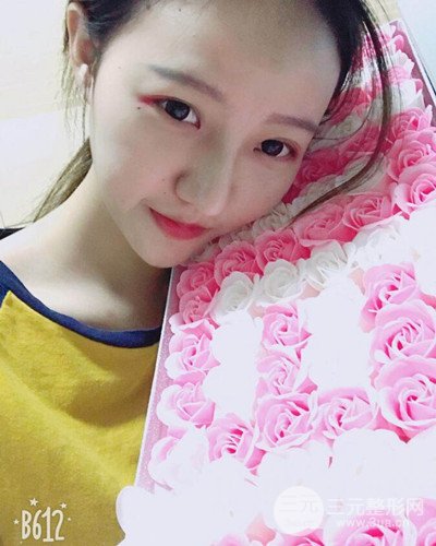 武漢美侖陳遠(yuǎn)海假體隆鼻案例，恢復(fù)過(guò)程分享~