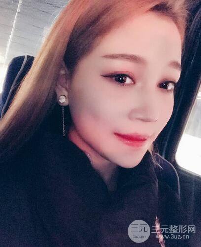 【下頜角+顴骨+下巴】全臉磨骨整形，術(shù)后的我人生開掛了！