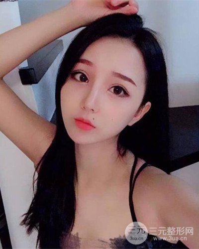 深圳蒳美邇朱燦醫(yī)生眼隆鼻整形案例分享，附上前后對比照~