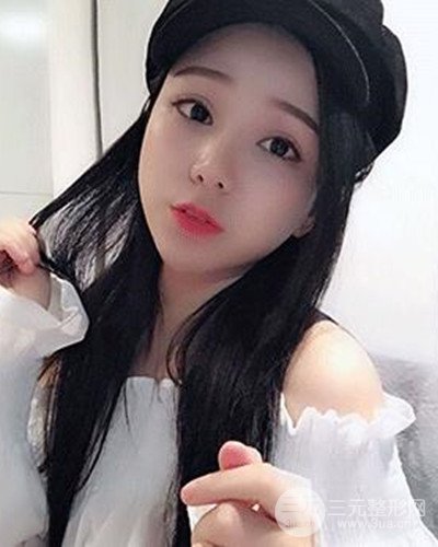 深圳蒳美邇朱燦醫(yī)生眼隆鼻整形案例分享，附上前后對比照~