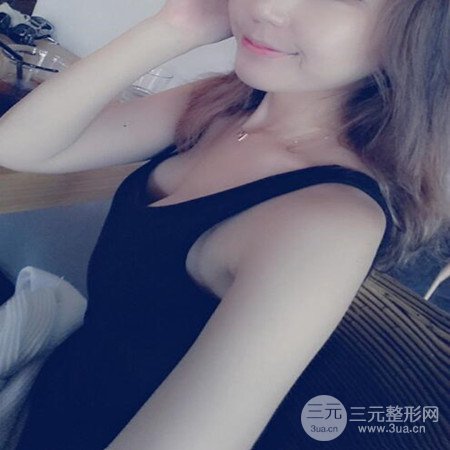 廣東省第二人民醫(yī)院羅盛康假體隆胸前后對比案例