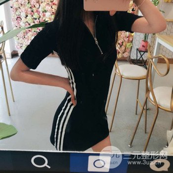 濟南腰腹吸脂案例三個月前后變化圖片分享