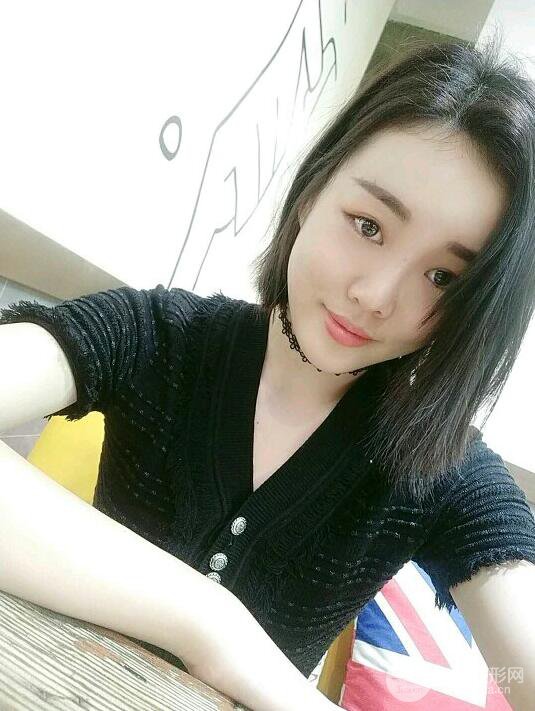 成都軍大鐘正強(qiáng)自體脂肪填充面部案例恢復(fù)圖，馬上變成“初戀臉”