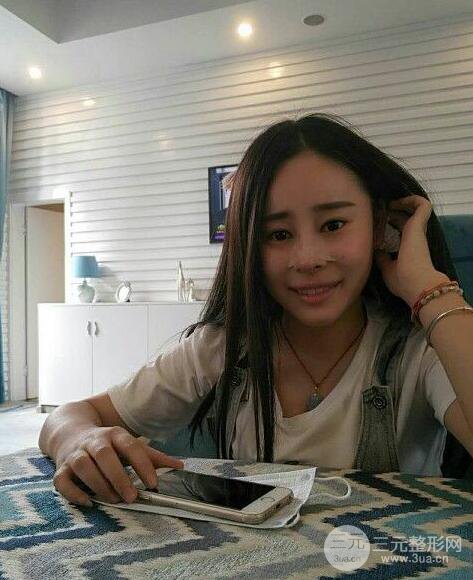 成都華顏賈德淵隆鼻失敗修復(fù)真實(shí)案例分享，并且附上前后對(duì)比照片