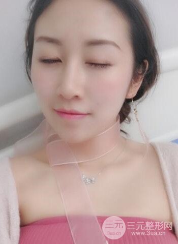 廣州隆鼻整形真實恢復(fù)期圖片，擁有精致美鼻不是夢