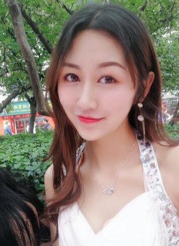 廣州隆鼻整形真實恢復(fù)期圖片，擁有精致美鼻不是夢