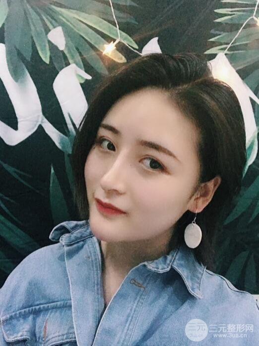 重慶五洲范文亮隆鼻整形案例，前后對比圖分享