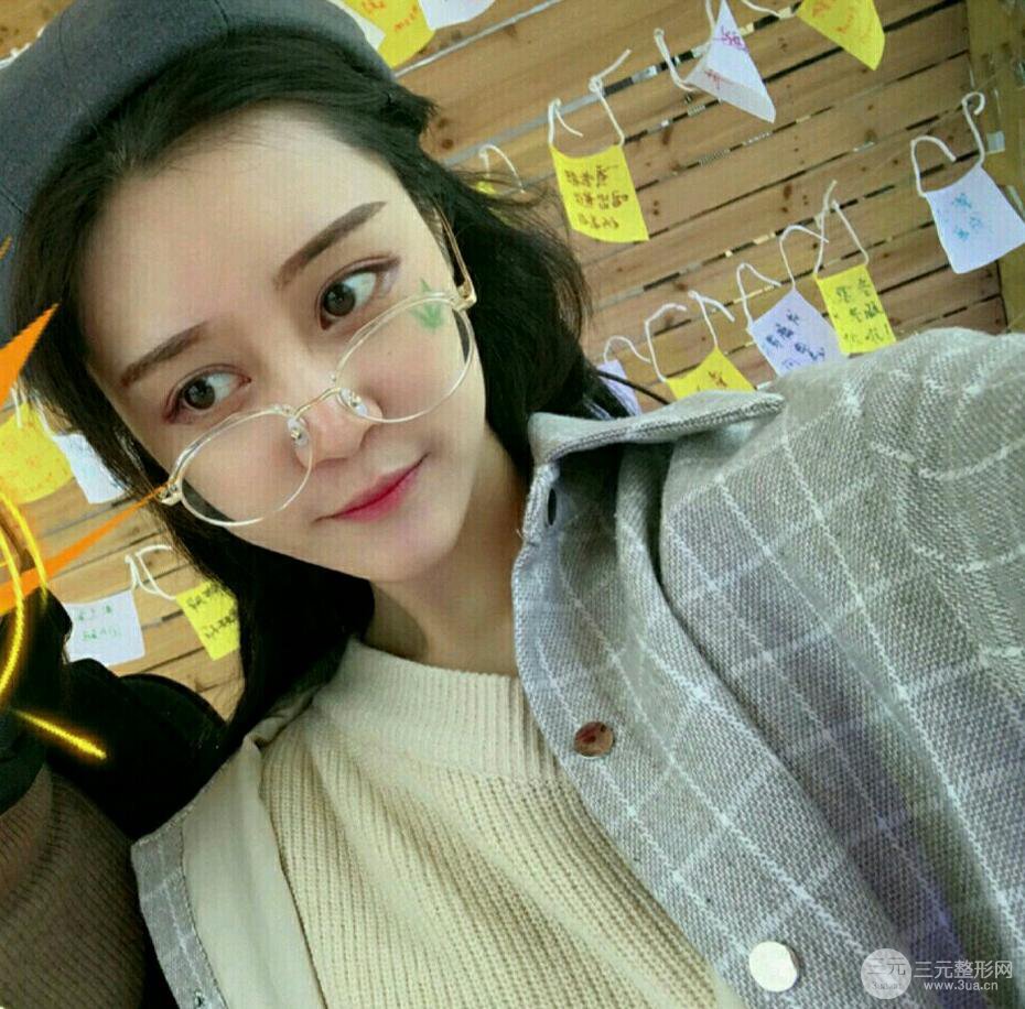 上海百*麗顧清自體脂肪填充恢復(fù)過程前后對比圖分享~