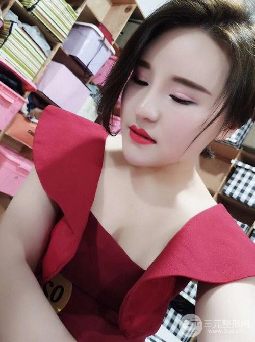 上海麗質(zhì)呂成醫(yī)生做的吸脂瘦臉日記，前后恢復(fù)圖分享