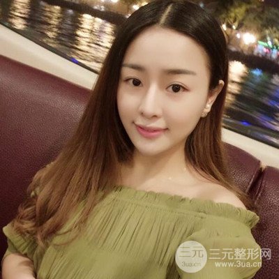 廣州藝美李闖醫(yī)生隆鼻整形恢復記錄分享~