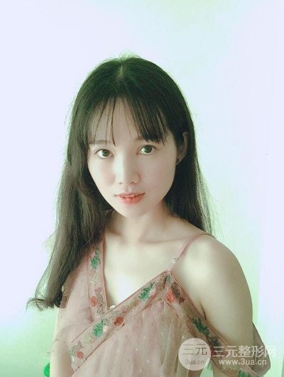 廣州晨曦切開雙眼皮恢復(fù)日記分享，附上前后對比圖