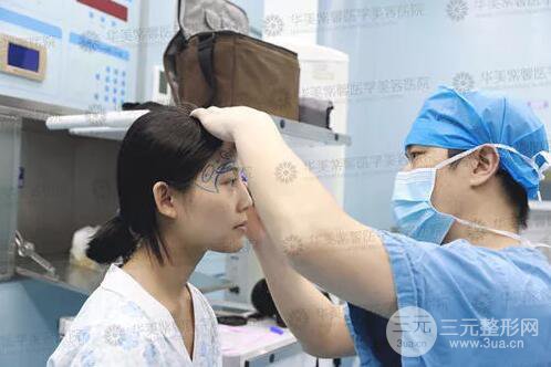 四川華美紫馨自體脂肪面部案例術后恢復日記