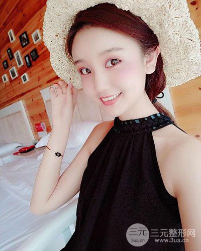 深圳蒳美邇朱燦自體脂肪填充日記分享