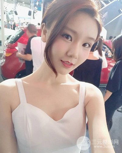 深圳蒳美邇朱燦自體脂肪填充日記分享