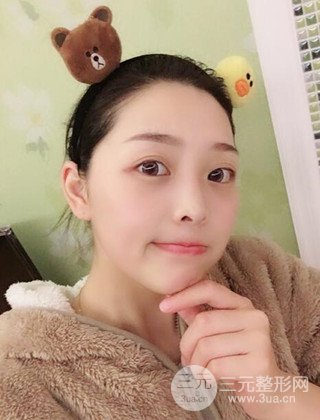 面部吸脂瘦臉手術(shù)日記分享，瘦臉果驚人