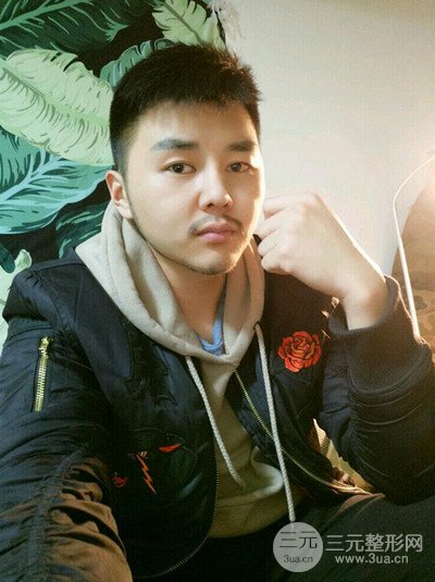 成都玉之光黃開亮醫(yī)生隆鼻修復(fù)整形案例，前后恢復(fù)過程分享