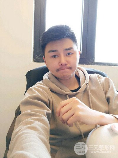 成都玉之光黃開亮醫(yī)生隆鼻修復(fù)整形案例，前后恢復(fù)過程分享