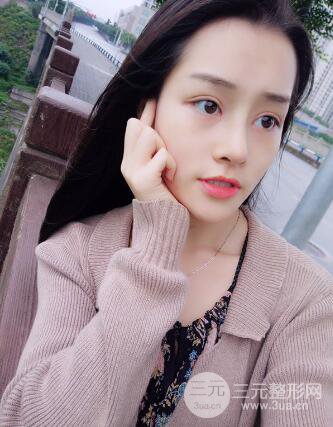 九院李青峰做鼻子的案例風(fēng)格果圖片分享