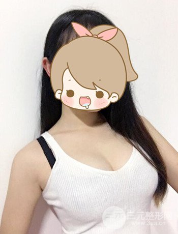 北京自體脂肪隆胸手術(shù)日記分享，豐胸術(shù)后恢復(fù)果圖