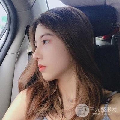 廣州藝美隆鼻日記分享！前后對比圖奉上！