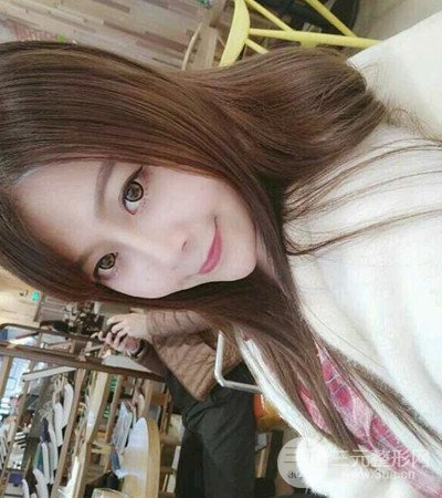 四川軍大鐘正強(qiáng)隆鼻案例日記分享