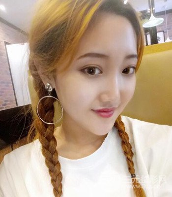 終于做了下頜角整形，分享術(shù)后恢復(fù)果