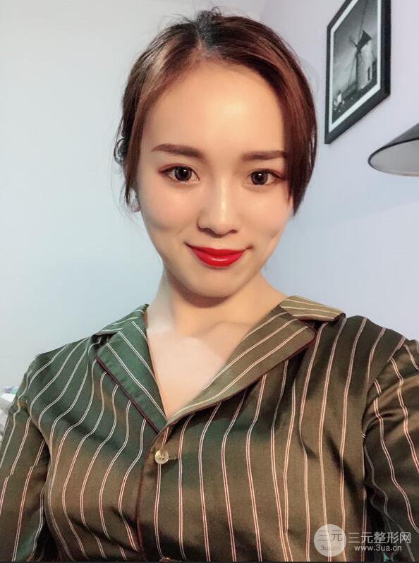 下頜角切除手術(shù)前后恢復(fù)對(duì)比圖過(guò)程分享