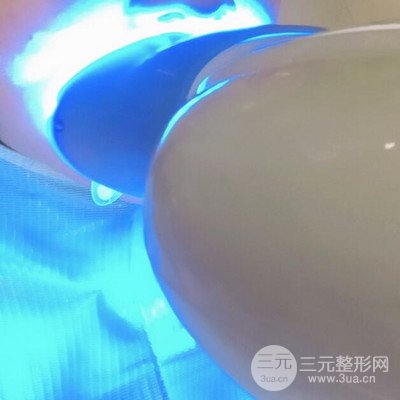 做了牙齒冷光美白果很棒，綻放美麗笑容