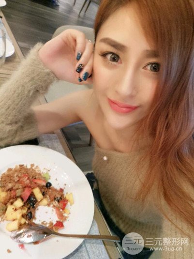 重慶鉑生王振榮隆鼻整形前后對比圖恢復過程分享