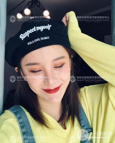 煤炭總醫(yī)院整形美容科自體脂肪填充案例