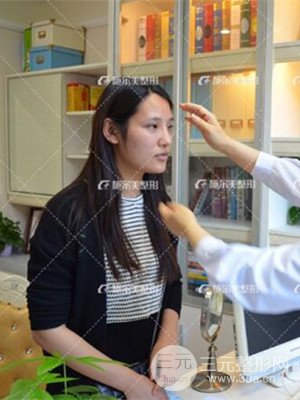 江蘇施爾美自體脂肪填充面部案例，前后對比圖分享