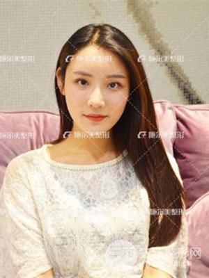 江蘇施爾美自體脂肪填充面部案例，前后對比圖分享