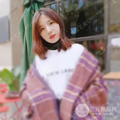 北京藝星隆鼻整形案例前后對比圖分享~