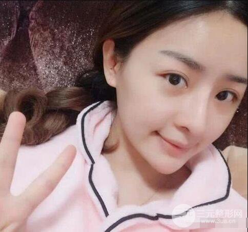 吉林銘醫(yī)李紅肋骨隆鼻整形前后對(duì)比圖果恢復(fù)心情小札