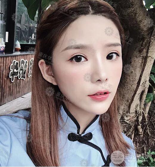 重慶萬州華美潘寶華雙眼皮+內(nèi)眼角前后對(duì)比圖被贊氣質(zhì)港風(fēng)女神!