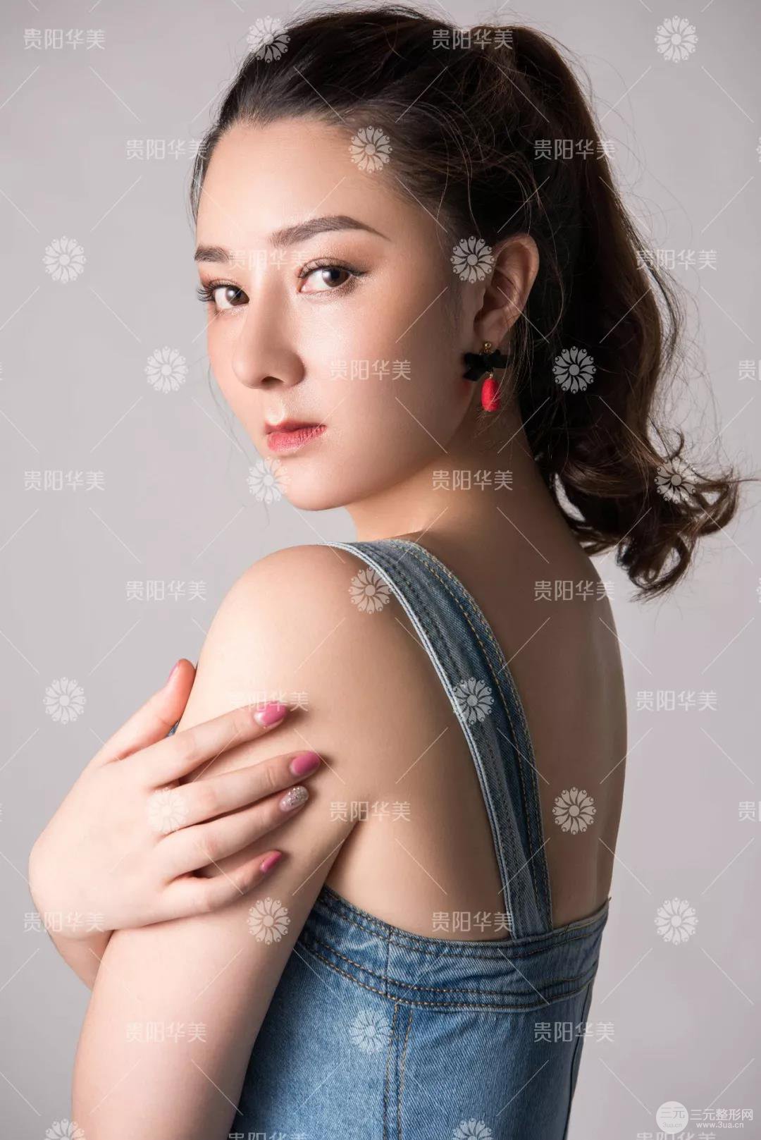 貴陽華美牛勇敢全切雙眼皮+假體隆鼻案例前后對比圖 華美員工全臉整形實錄