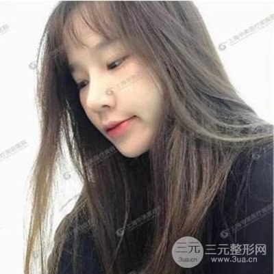 上海華美李志海隆鼻整形案例前后對比圖分享~