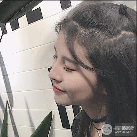 成都華西醫(yī)院整形美容科卿勇隆鼻整形前后對比圖恢復(fù)心情小札