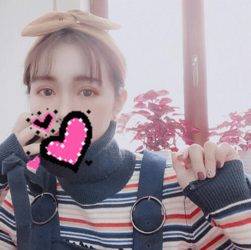 揚州艾菲斯黃嬋雙眼皮案例術(shù)后恢復(fù)果