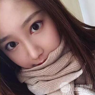 硅膠假體隆鼻案例前后對(duì)比圖分享！顏值變化驚人！