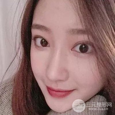 硅膠假體隆鼻案例前后對(duì)比圖分享！顏值變化驚人！