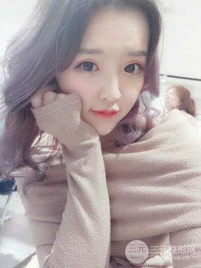 成都天使之翼張勁松切開(kāi)雙眼皮案例前后對(duì)比圖心情小札