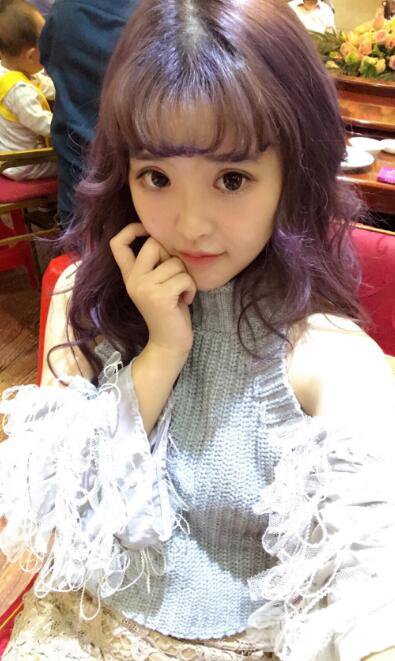 成都天使之翼張勁松切開(kāi)雙眼皮案例前后對(duì)比圖心情小札