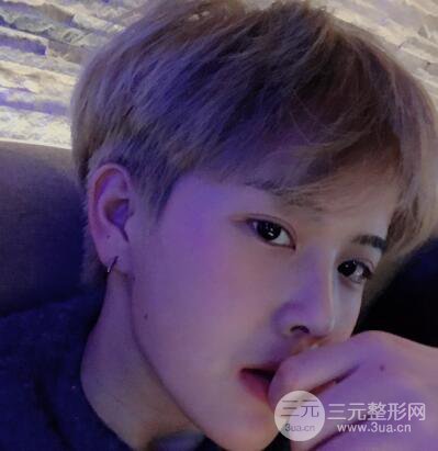 哈醫(yī)大二院整形科肖志波割雙眼皮對比圖男性案例