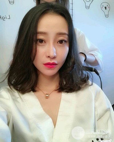 北京雍禾韓巖發(fā)際線種植手術(shù)半年了，分享前后果圖片~