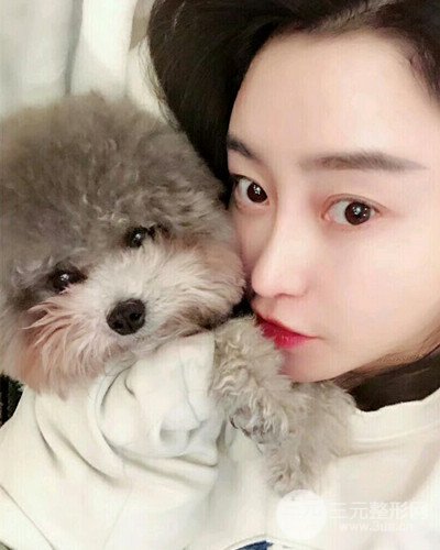 北京雍禾韓巖發(fā)際線種植手術(shù)半年了，分享前后果圖片~