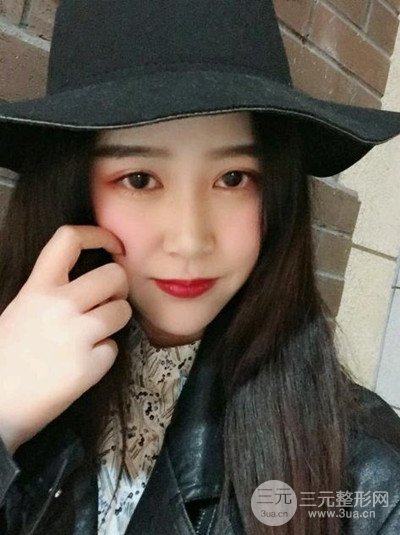 四川友誼李萍醫(yī)生假體墊下巴前后對比果圖片分享~