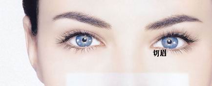切眉手術(shù)的注意事項有哪些