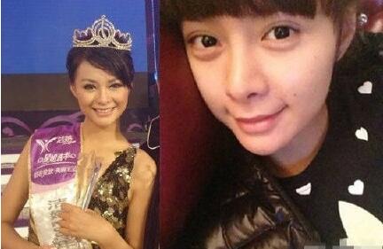 沈夢(mèng)辰,個(gè)人,資料,整容,前后,對(duì)比